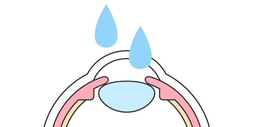 点眼による局所麻酔